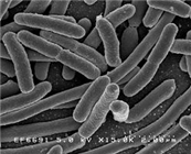 Escherichia coli (E. coli) Public Domain Photograph
